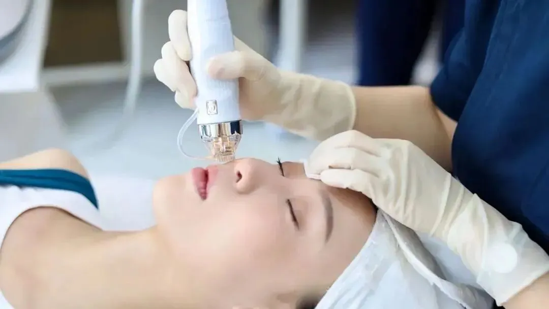 microneedling for face in spa clinic